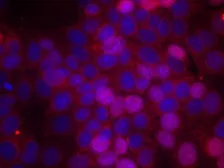 Anti-Estrogen Receptor alpha (phospho Ser106) antibody used in Immunocytochemistry/ Immunofluorescence (ICC/IF). GTX50138