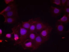 Anti-Estrogen Receptor alpha (phospho Ser118) antibody used in Immunocytochemistry/ Immunofluorescence (ICC/IF). GTX50139
