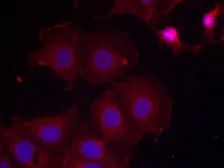 Anti-Her2 / ErbB2 (phospho Tyr877) antibody used in Immunocytochemistry/ Immunofluorescence (ICC/IF). GTX50142