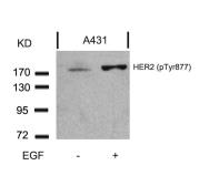 Anti-Her2 / ErbB2 (phospho Tyr877) antibody used in Western Blot (WB). GTX50142
