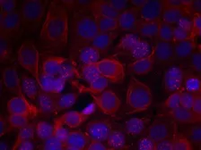 Anti-Her2 / ErbB2 (phospho Tyr1221/Tyr1222) antibody used in Immunocytochemistry/ Immunofluorescence (ICC/IF). GTX50143
