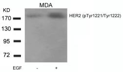 Anti-Her2 / ErbB2 (phospho Tyr1221/Tyr1222) antibody used in Western Blot (WB). GTX50143