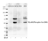 Anti-MyoD1 (phospho Ser200) antibody used in Western Blot (WB). GTX50144