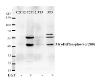 Anti-MyoD1 (phospho Ser200) antibody used in Western Blot (WB). GTX50144