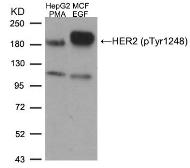 Anti-Her2 / ErbB2 (phospho Tyr1248) antibody used in Western Blot (WB). GTX50146