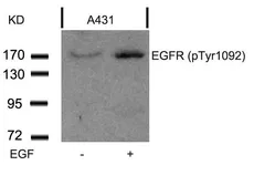 Anti-EGFR (phospho Tyr1068) antibody used in Western Blot (WB). GTX50148