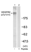 Anti-VEGF Receptor 2 (phospho Tyr1214) antibody used in Western Blot (WB). GTX50152