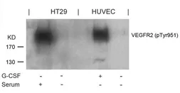Anti-VEGF Receptor 2 (phospho Tyr951) antibody used in Western Blot (WB). GTX50153