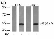 Anti-p53 (phospho Ser6) antibody used in Western Blot (WB). GTX50157