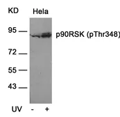 Anti-p90 RSK1 (phospho Thr359) antibody used in Western Blot (WB). GTX50169