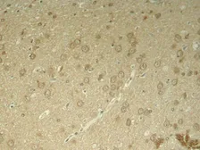 Anti-Tau (phospho Thr205) antibody used in IHC (Paraffin sections) (IHC-P). GTX50172
