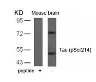 Anti-Tau (phospho Ser214) antibody used in Western Blot (WB). GTX50173