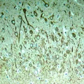 Anti-Tau (phospho Thr231) antibody used in IHC (Paraffin sections) (IHC-P). GTX50174