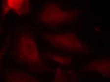 Anti-Tau (phospho Ser404) antibody used in Immunocytochemistry/ Immunofluorescence (ICC/IF). GTX50176