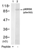 Anti-p90 RSK1 (phospho Ser363) antibody used in Western Blot (WB). GTX50177