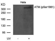 Anti-ATM (phospho Ser1981) antibody used in Western Blot (WB). GTX50184