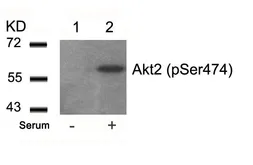 Anti-AKT (phospho Ser473) antibody used in Western Blot (WB). GTX50186