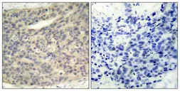 Anti-LIMK1 (phospho Thr508) + LIMK2 (phospho Thr505) antibody used in IHC (Paraffin sections) (IHC-P). GTX50187
