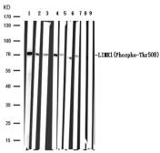 Anti-LIMK1 (phospho Thr508) + LIMK2 (phospho Thr505) antibody used in Western Blot (WB). GTX50187