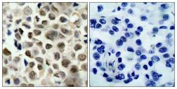 Anti-HDAC8 (phospho Ser39) antibody used in IHC (Paraffin sections) (IHC-P). GTX50189