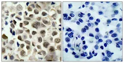 Anti-HDAC8 (phospho Ser39) antibody used in IHC (Paraffin sections) (IHC-P). GTX50189
