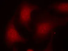 Anti-Rb (phospho Ser795) antibody used in Immunocytochemistry/ Immunofluorescence (ICC/IF). GTX50191