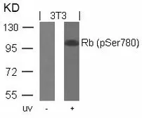 Anti-Rb (phospho Ser780) antibody used in Western Blot (WB). GTX50193