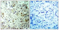 Anti-CDK2 (phospho Thr160) antibody used in IHC (Paraffin sections) (IHC-P). GTX50194