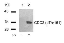 Anti-CDC2 (phospho Thr161) antibody used in Western Blot (WB). GTX50195