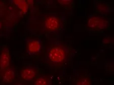 Anti-FOXO4 (phospho Ser197) antibody used in Immunocytochemistry/ Immunofluorescence (ICC/IF). GTX50197