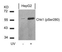 Anti-Chk1 (phospho Ser280) antibody used in Western Blot (WB). GTX50200