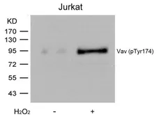 Anti-VAV1 (phospho Tyr174) antibody used in Western Blot (WB). GTX50201