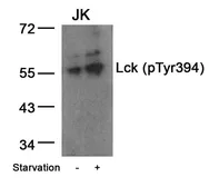 Anti-Lck (phospho Tyr394) antibody used in Western Blot (WB). GTX50202