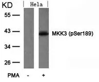 Anti-MEK3 (phospho Ser189) antibody used in Western Blot (WB). GTX50203