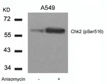 Anti-Chk2 (phospho Ser516) antibody used in Western Blot (WB). GTX50205