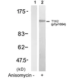 Anti-TYK2 (phospho Tyr1054) antibody used in Western Blot (WB). GTX50206