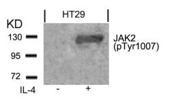 Anti-JAK2 (phospho Tyr1007) antibody used in Western Blot (WB). GTX50208