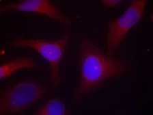 Anti-IKB alpha (phospho Ser32/Ser36) antibody used in Immunocytochemistry/ Immunofluorescence (ICC/IF). GTX50209