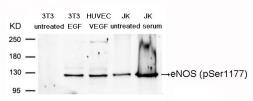 Anti-eNOS (phospho Ser1177) antibody used in Western Blot (WB). GTX50212