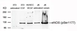 Anti-eNOS (phospho Ser1177) antibody used in Western Blot (WB). GTX50212