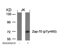 Anti-ZAP70 (phospho Tyr493) antibody used in Western Blot (WB). GTX50215