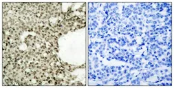 Anti-STAT1 (phospho Ser727) antibody used in IHC (Paraffin sections) (IHC-P). GTX50217