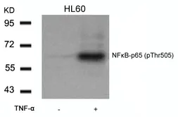 Anti-NFkB p65 (phospho Thr505) antibody used in Western Blot (WB). GTX50219
