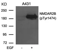 Anti-NMDAR2B (phospho Tyr1472) antibody used in Western Blot (WB). GTX50221