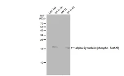 Anti-alpha Synuclein (phospho Ser129) antibody used in Western Blot (WB). GTX50222