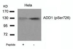 Anti-alpha Adducin (phospho Ser726) antibody used in Western Blot (WB). GTX50230