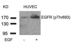 Anti-EGFR (phospho Thr669) antibody used in Western Blot (WB). GTX50234