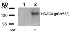 Anti-HDAC4 (phospho Ser632) antibody used in Western Blot (WB). GTX50237