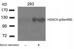 Anti-HDAC5 (phospho Ser498) antibody used in Western Blot (WB). GTX50238