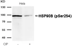 Anti-Hsp90 beta (phospho Ser254) antibody used in Western Blot (WB). GTX50240